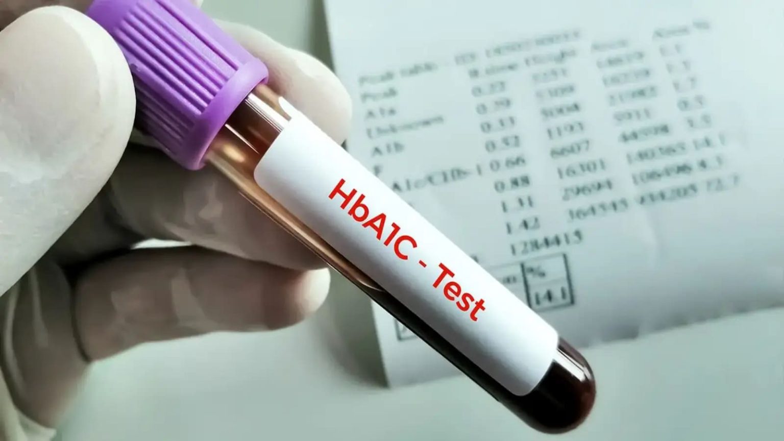 Can diabetics fully depend on HbA1c levels? Know all about blood sugar fluctuations