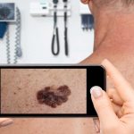Is your skin app misleading you? Why seeing a dermatologist is necessary