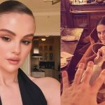 Selena Gomez reveals lupus caused arthritis in her fingers! Know if you are at risk too