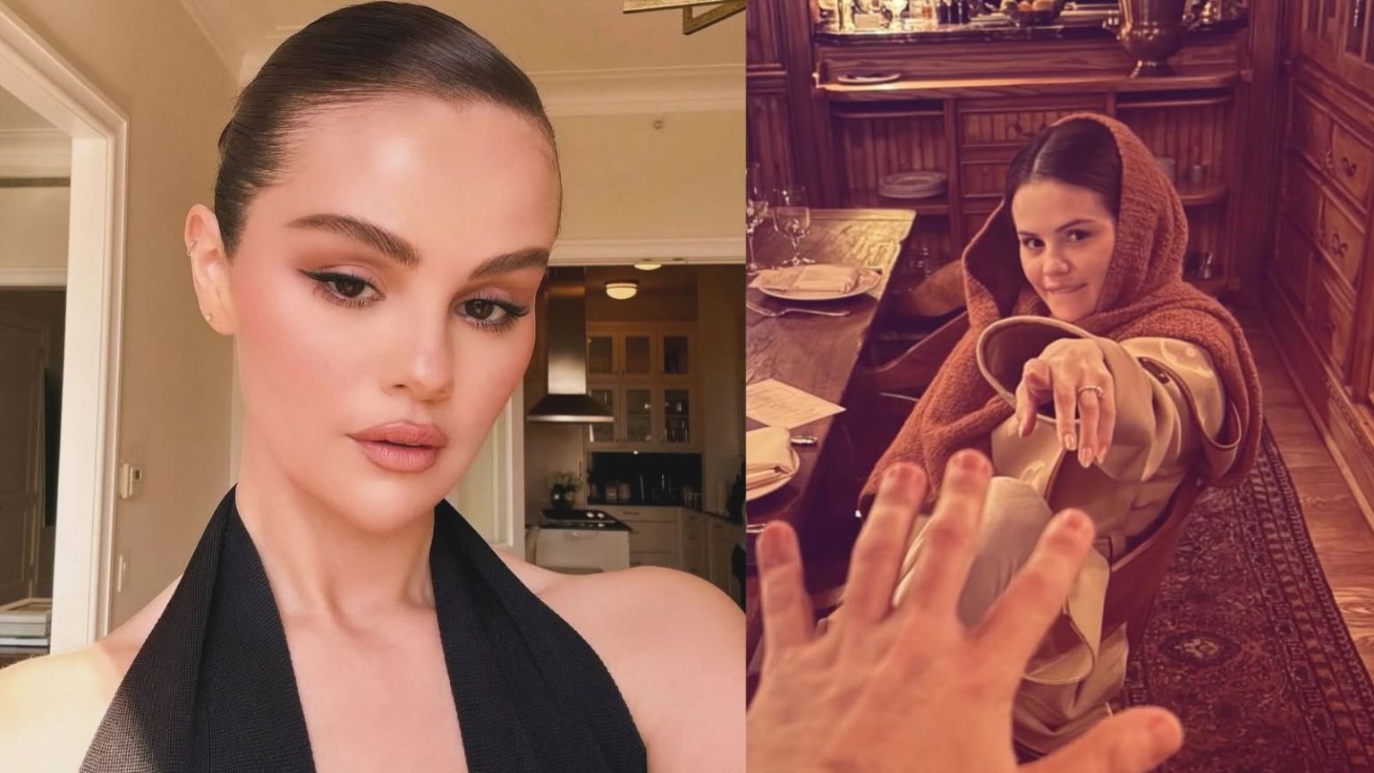 Selena Gomez reveals lupus caused arthritis in her fingers! Know if you are at risk too