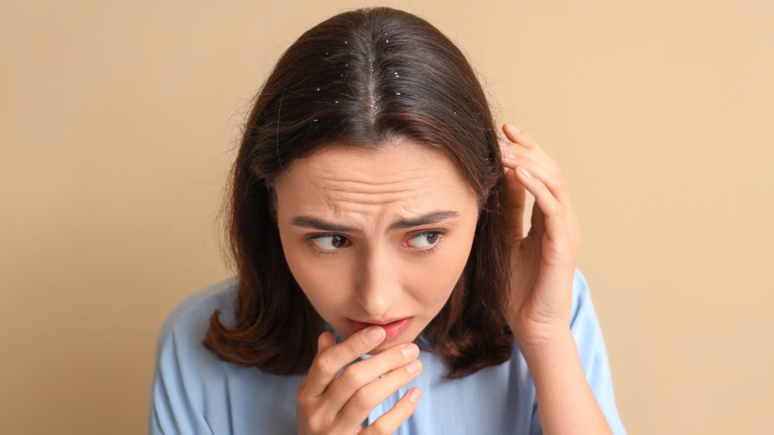 Say goodbye to dandruff naturally with this ancient spice