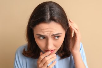 Say goodbye to dandruff naturally with this ancient spice