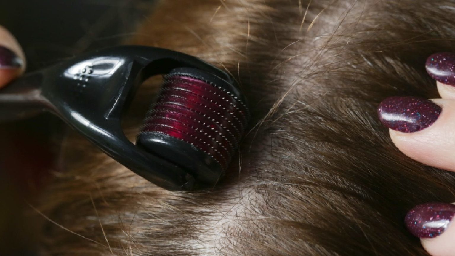 Thinking about a derma roller for hair growth? Here’s how to start