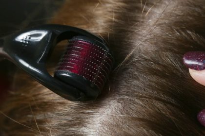 Thinking about a derma roller for hair growth? Here’s how to start