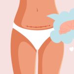 does a c section affect the baby