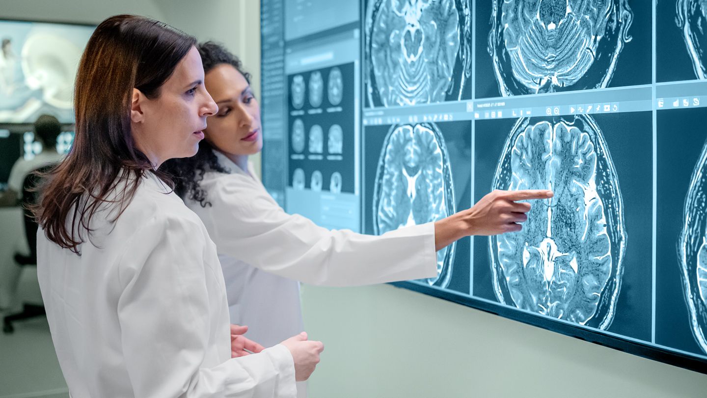 Could You Have ‘Cognitive-Only’ MS and Not Know It?