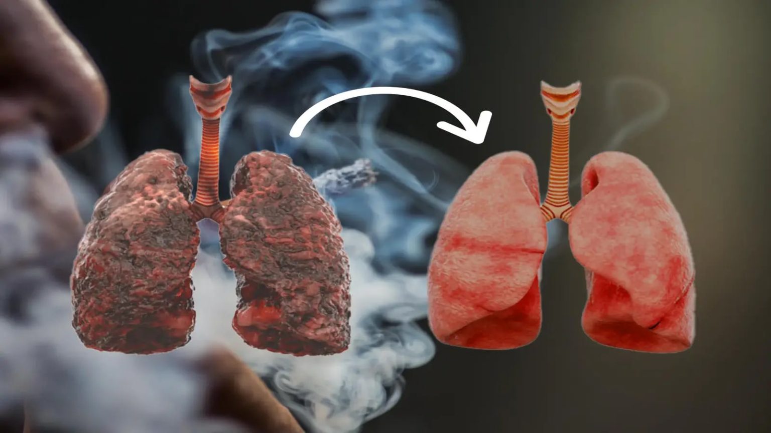 Air pollution, smoking, and nagging cough: When to get a lung function test?