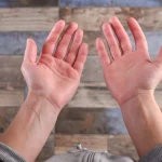 Red Palms? Here’s What Your Body Is Trying to Tell You