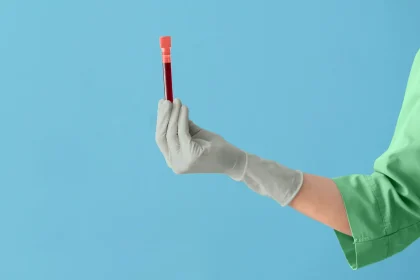 New Test May Help Predict if Stage 0 Breast Cancer Will Become Invasive