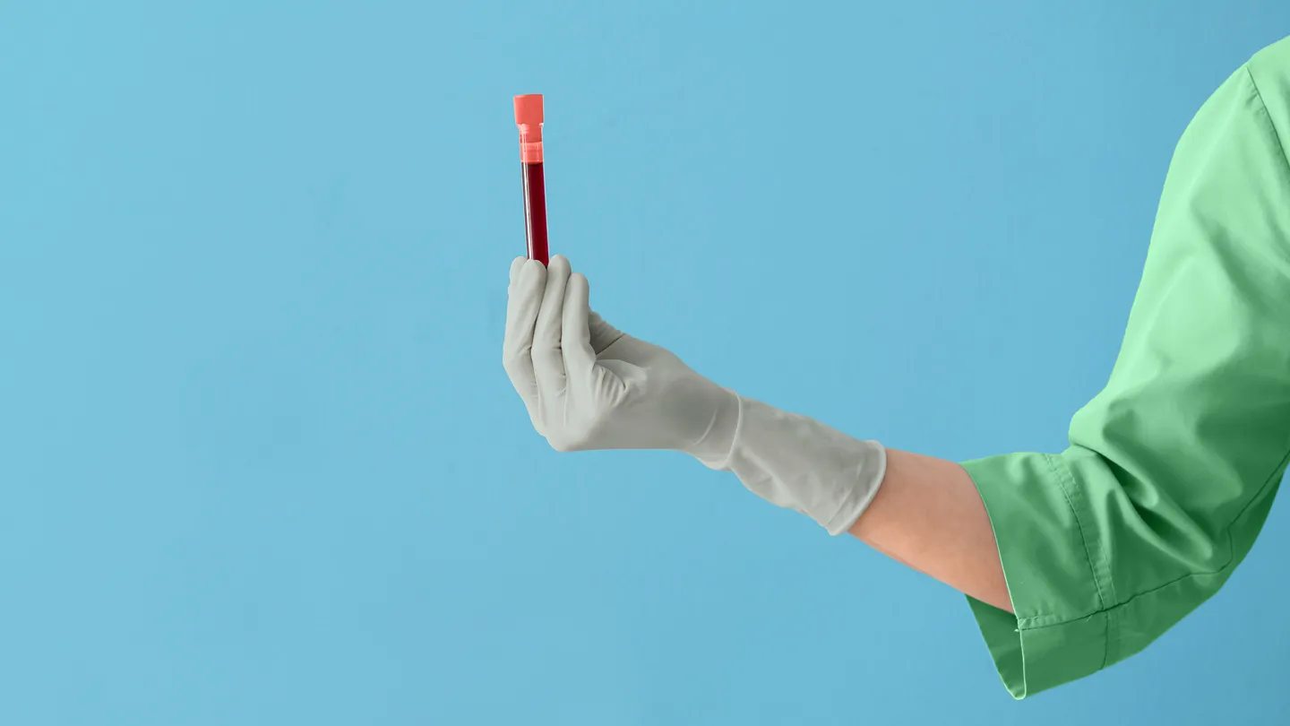 New Test May Help Predict if Stage 0 Breast Cancer Will Become Invasive