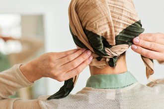 7 Ways to Cope With Hair Loss From Alopecia Areata