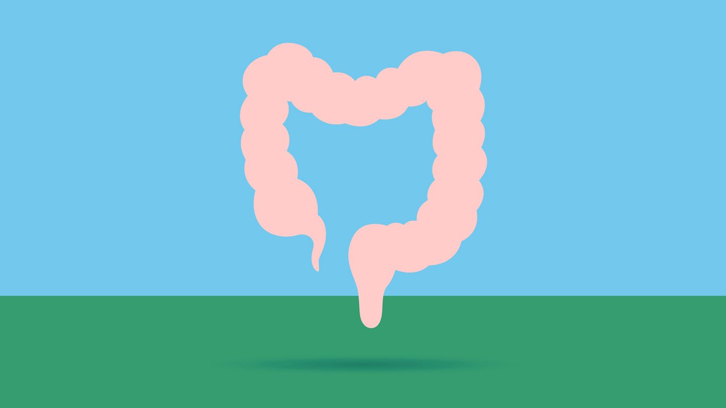 Rectal Bleeding Linked With 8.5 Times Higher Risk for Colorectal Cancer in Younger Adults
