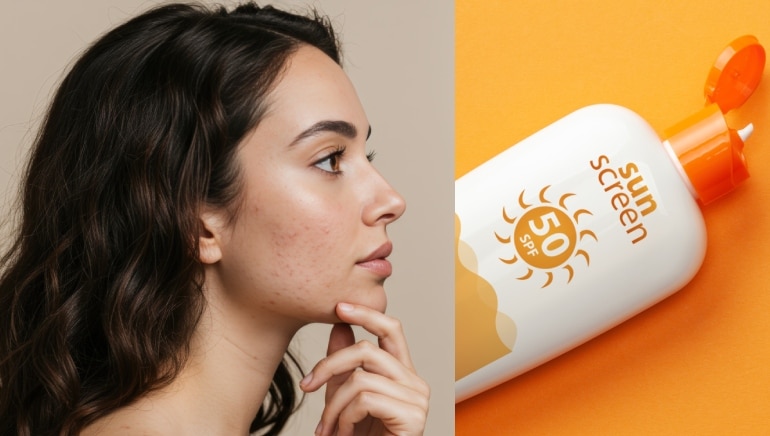 7 In-Vivo tested sunscreens proven for better UV defence and healthier skin