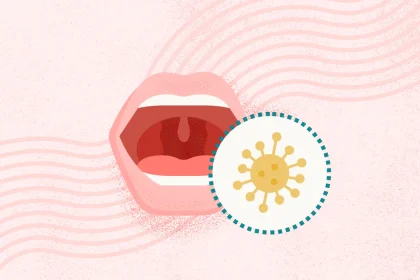 What Is Mononucleosis?