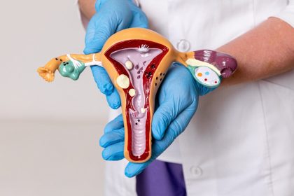 Can PCOS increase your diabetes risk? Here’s what every woman should know