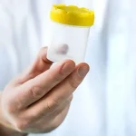 How a Kidney Infection Is Diagnosed