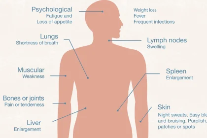 Leukemia Symptoms