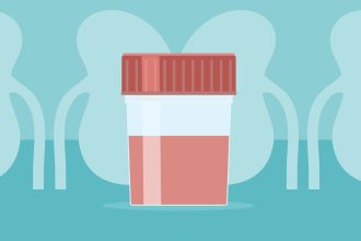 The IgAN Post-Infection Flare: Your Step-by-Step Action Plan