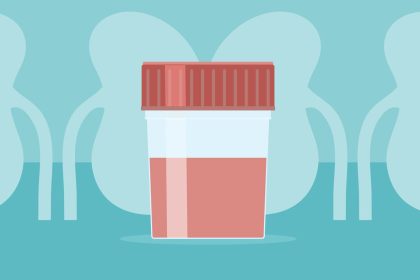 The IgAN Post-Infection Flare: Your Step-by-Step Action Plan