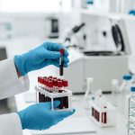 GPA vs. MPA vs. EGPA: A Guide to Your Specific ANCA Vasculitis Subtype